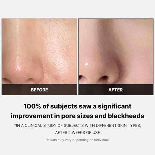 PADS ZERO PORE 70 UNIDADES