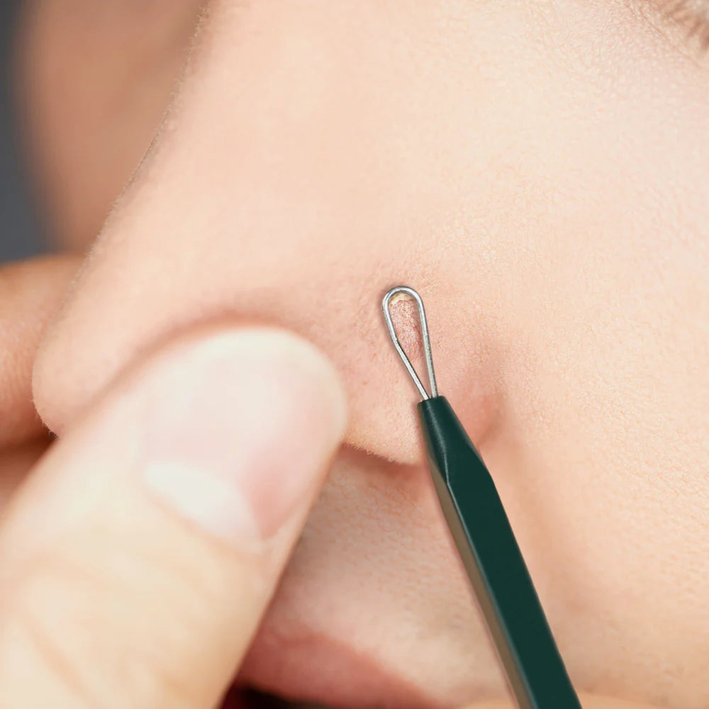 KIT PIMPLE EXTRACTOR